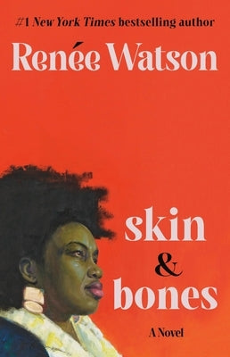 Skin & Bones by Watson, Ren&#233;e